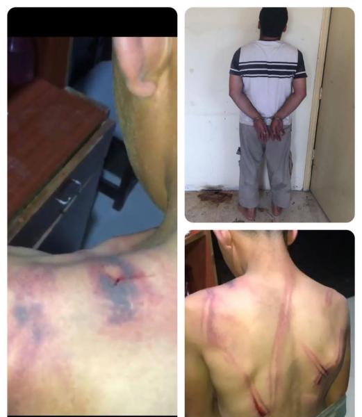 Man Who Flogged His Minor Son In Lebanon Got Arrested 1
